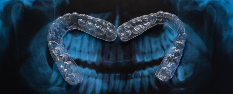 invisalign trays